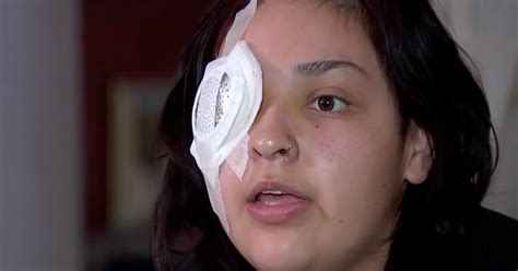 No me arrepiento la joven latina que perdió un ojo tras ser golpeada