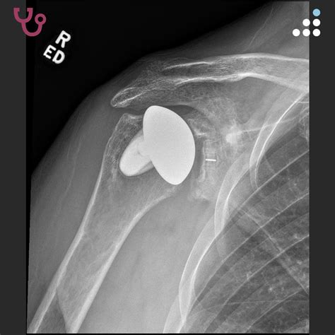 orthobullets     case  dr emily benson  community