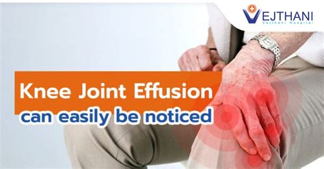 joint effusion
