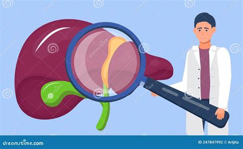 Hepatology Doctor Looks Through A Magnifying Glass At Liver Cancer Concept Vector For Medical