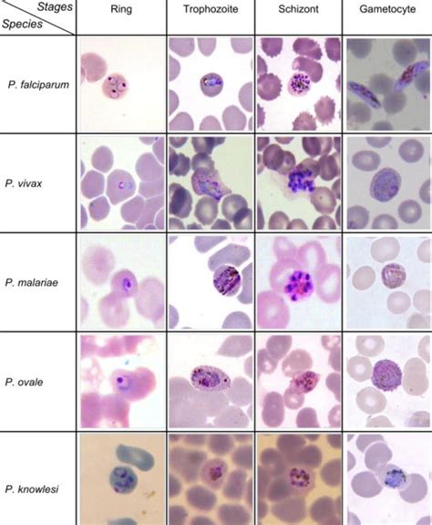 Causes of malaria | Medicines for Malaria Venture