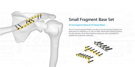 Midshaft Clavicle Acumed Information