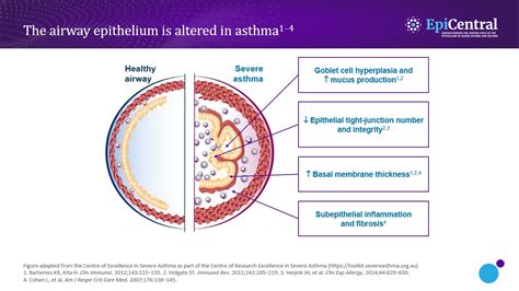 Role Of The Epithelium In Asthma Az Epicentral Us