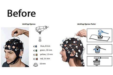 EEG Headset Design - Metotec Design Lab