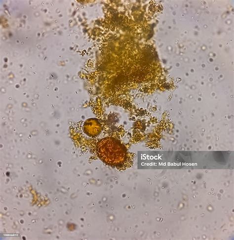 Entamoeba Coli Nas Fezes - 6