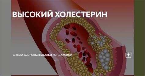 ВЫСОКИЙ ХОЛЕСТЕРИН | Академия практической натуропатии и нутрициологии ...