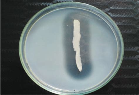 Gelatin Hydrolysis Test