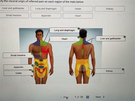 Chapter Quiz Sense Organs Flashcards Quizlet