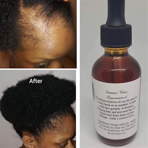 Hair Oil For Dry Damaged Hair, Hair Growth Treatment Oil, 20 ESSENTIAL ...