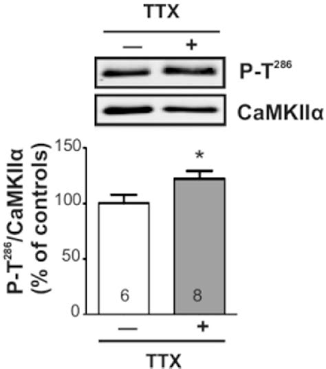 Differential CaMKII Regulation By Voltage Gated Calcium Channels In The