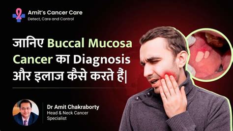 Buccal Mucosa Cancer Diagnosis And Treatment Dr Amit Chakraborty