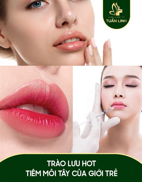 Trào lưu HOT tiêm môi tây của giới trẻ hiện nay ra sao