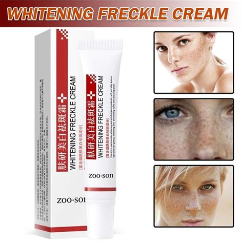 Buy Melasma And Freckle Cream Freckle Cream Remove Dark Spots Anti