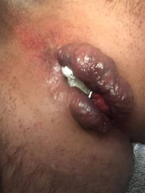 Tunnel Plug 29 Nude Pics XHamster