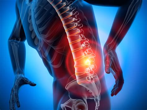 Understanding Herniated Disks Franciscan Health