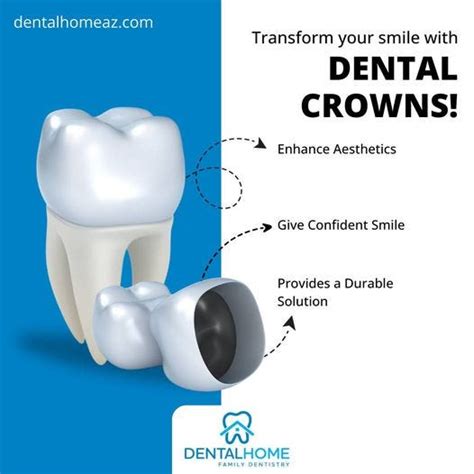 Crowns for Your Teeth! 🦷 - Dentalhomefamilydentistry - Medium