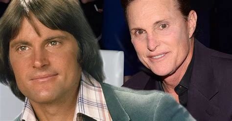 Bruce Jenner Could Spend Up To 250 000 On Sex Change If He Has FULL Gender Reassignment