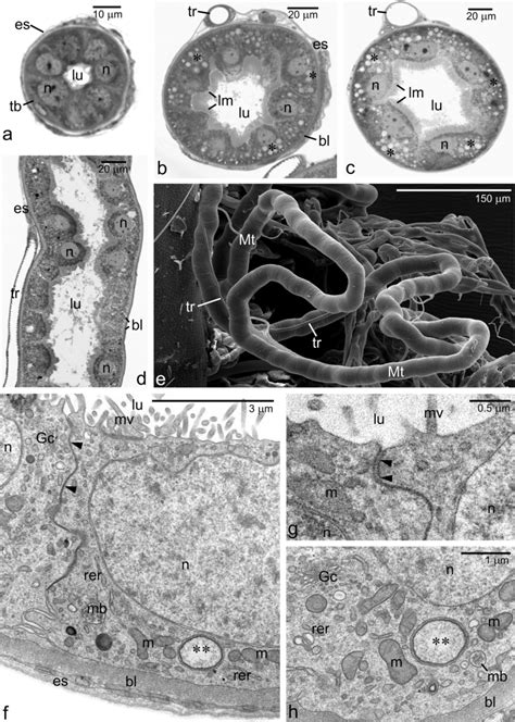 malpighian tubule mt development   esau   cross sections  mt
