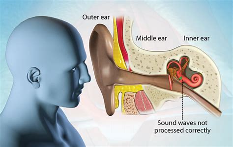 Health Condition Symptoms Causes Treatment And More