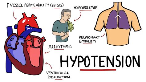 Get Low Blood Pressure Hypotension You Wish You Knew Before BUTN