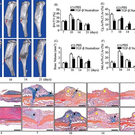 Tgf Neutralizing Antibody Results In A Delayed Enchondral Bone