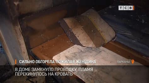Сильно обгорела пожилая женщина - YouTube