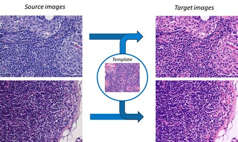 Histopathology Stain Color Normalization