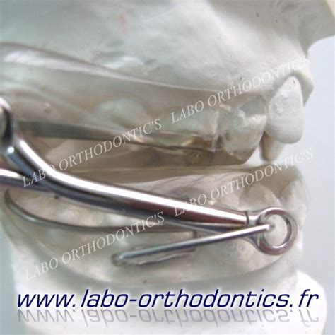 Orthodontie Les Fonctionnels Laboratoire Orthodontics