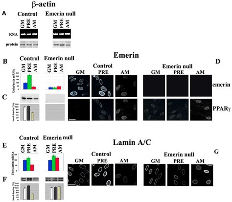 Dynamic Changes In Lamins A C And Emerin Expression In Different Stages