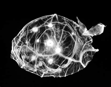 Free picture: smallpox, virus, chorioallantoic, membrane, developing