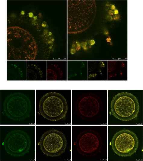 Combined Jc And Cellrox Tm Deep Red Staining Of Ccs A And Oocytes