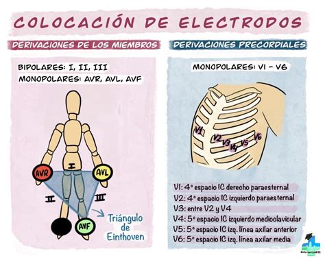 Dónde coloco los electrodos On enfermería