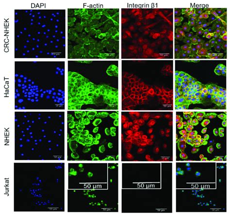 Human Keratinocytes Crc Hfk Hacat And Nhek But Not Jurkat T Cells