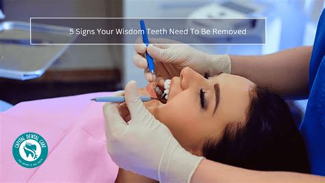 5 Signs Your Wisdom Teeth Need To Be Removed