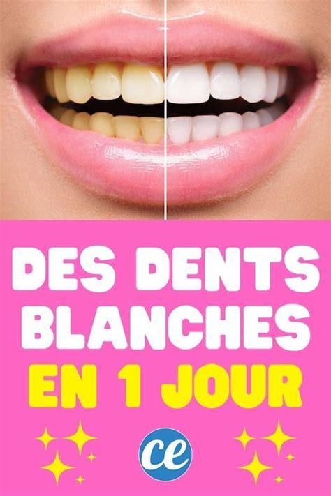 5 Astuces Pour Blanchir Ses Dents Naturellement Artofit