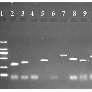 PCR Results Of Virulence Genes Of Escherichia Coli O78 K80 DNA Ladder