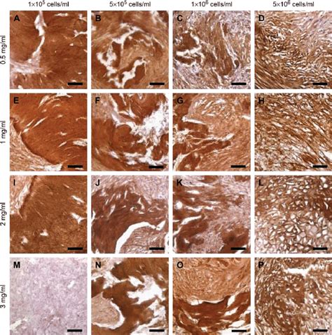 Immunohistochemical Staining For Type Ii Collagen Of Collagen Hmsc