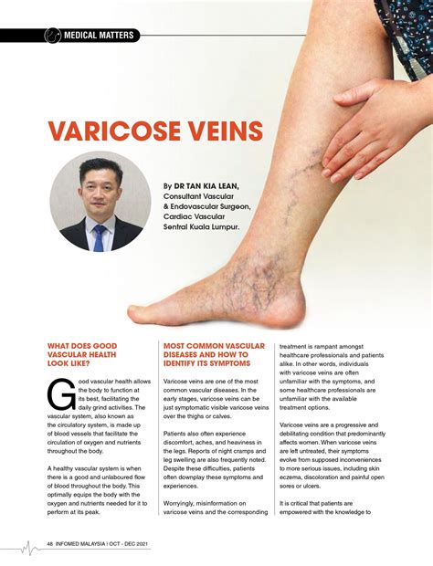 Varicose Veins - CVSKL