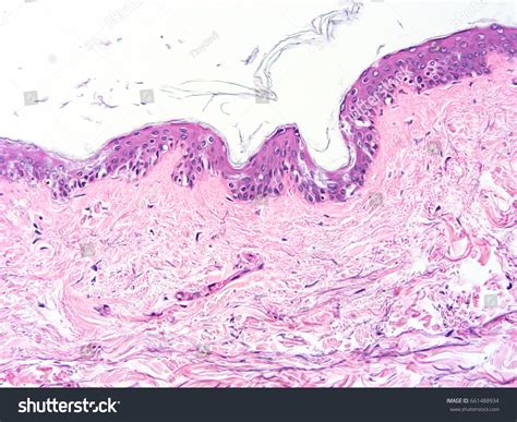 Human Epidermis Histology