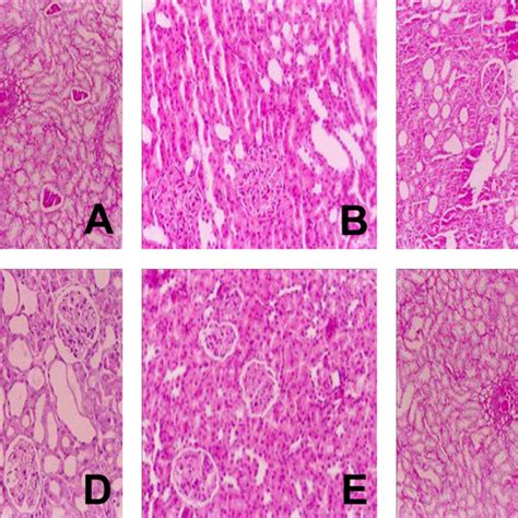 Histological Observations Of The Groups Treated With Test Extracts Of