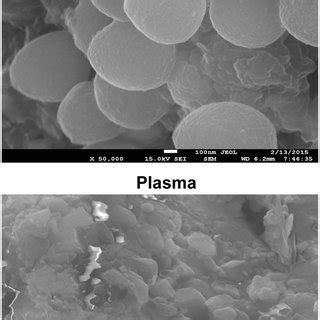 Scanning electron micrographs of S. aureus in artificial saliva after ...
