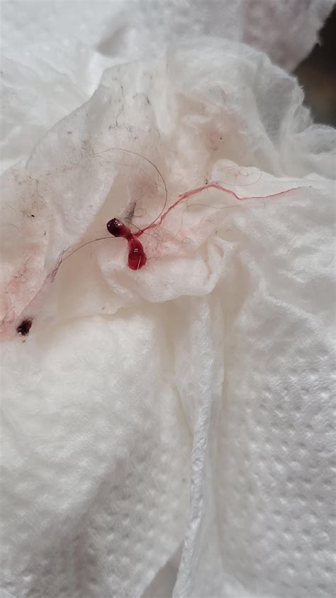 Blood clot in turtle pee? : r/reptiles