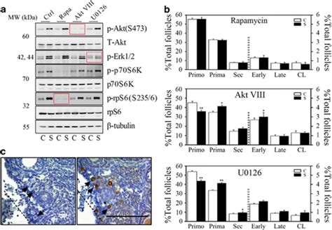 Restricting The Induction Of Ngf In Ovarian Stroma Engenders Selective