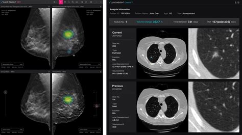 Lunit To Participate In Rsna Presenting Its New Ai Solutions For