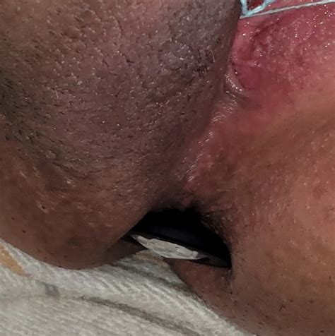 Arsch Nude Pics XHamster