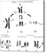 Burkitt S Lymphoma Photograph By National Cancer Institute Science