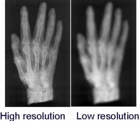 Effect Of Focal Spot On Resolution Contact Radiograph Off