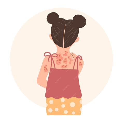 Premium Vector | Allergic itching skin inflammation redness and