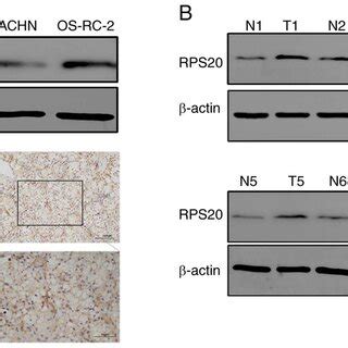 RPS Knockdown Inhibits Tumor Growth In Nude Mice A RPS Knockdown