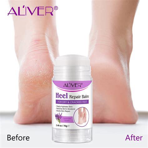 Aliver Cracked Heel Repair Balm Stick-Lavender Scent Heel Repair Balm